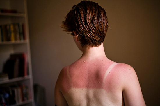 To Use Sunscreen or Not To Use Sunscreen