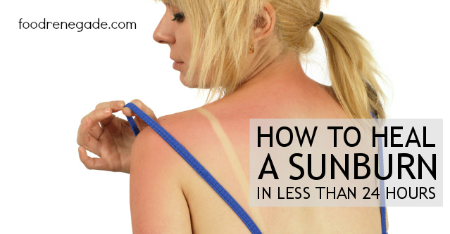 How To Heal A Sunburn in Less Than 24 Hours